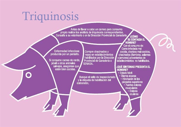 triquinosis